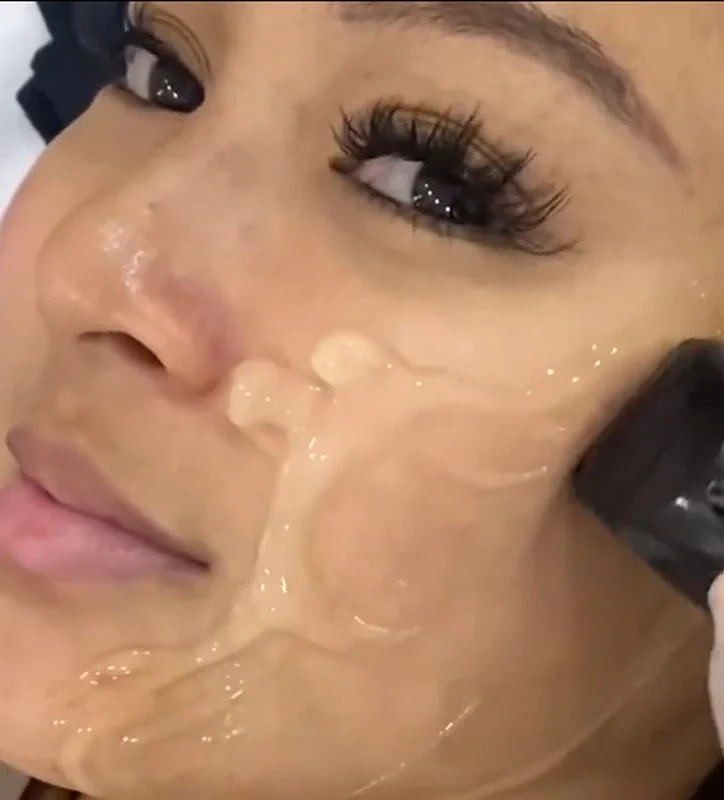 Aivee Beverly Hills Lift treatment