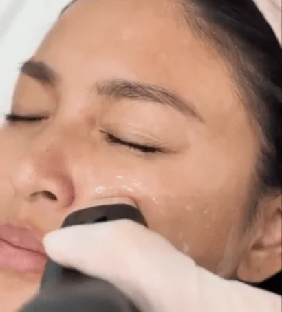Aivee Density treatment