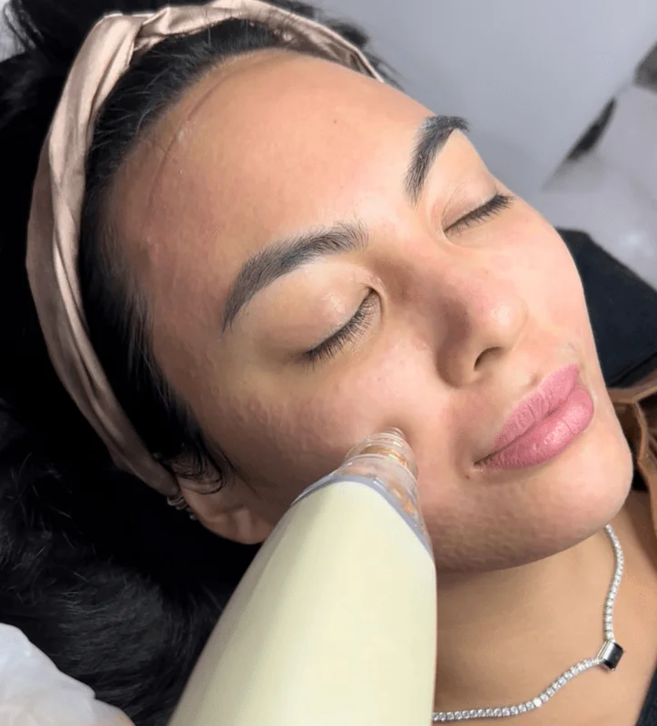 Aivee Potenza treatment
