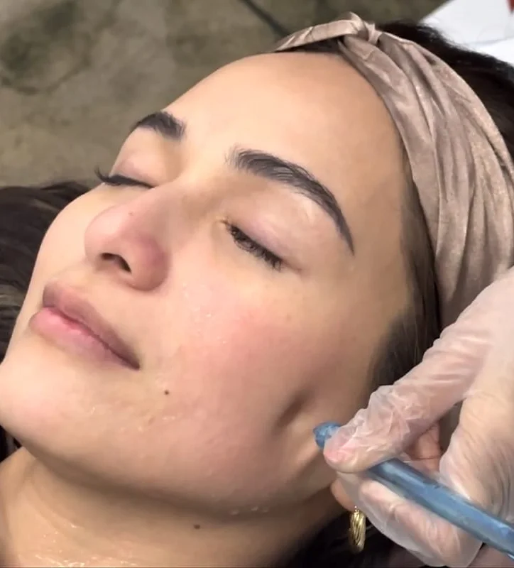 Aivee Sapphire treatment