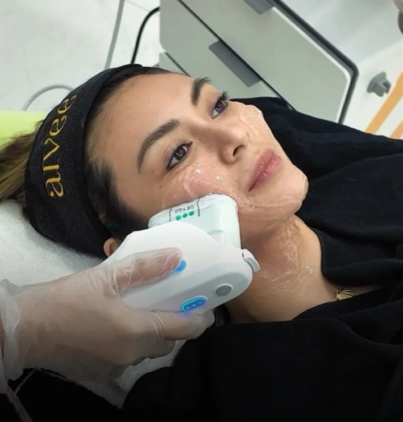 A gloved hand guiding an Ulthera Prime handpiece along a client’s jawline