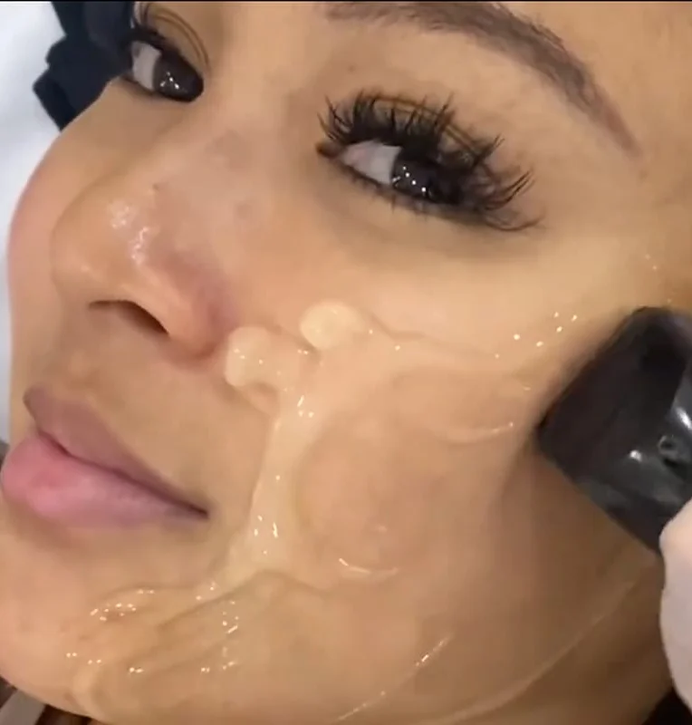 Aivee Beverly Hills Lift treatment