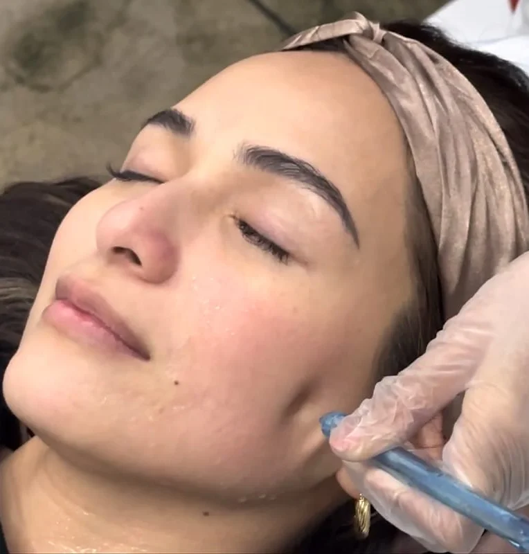 Aivee Sapphire treatment